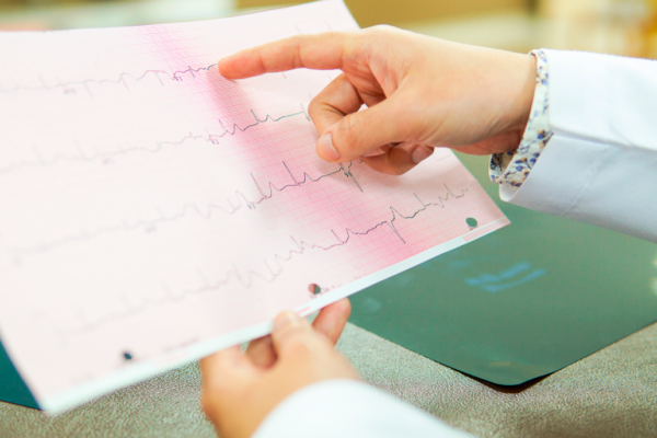 electrocardiograma_resultados