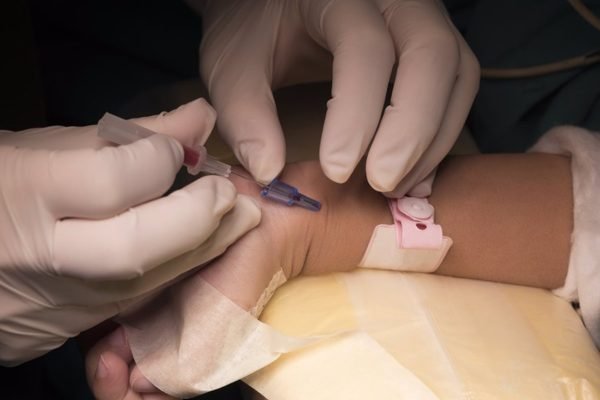 Gasometría arterial, análisis de sangre desde la arteria de la muñeca.
SALUD
GETTY